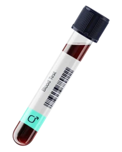Urban TRT Testosterone Blood Testing UK