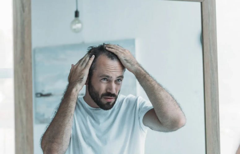 Hair Loss Treatments for Hair Loss and Male Pattern Baldness Urban TRT TRT UK