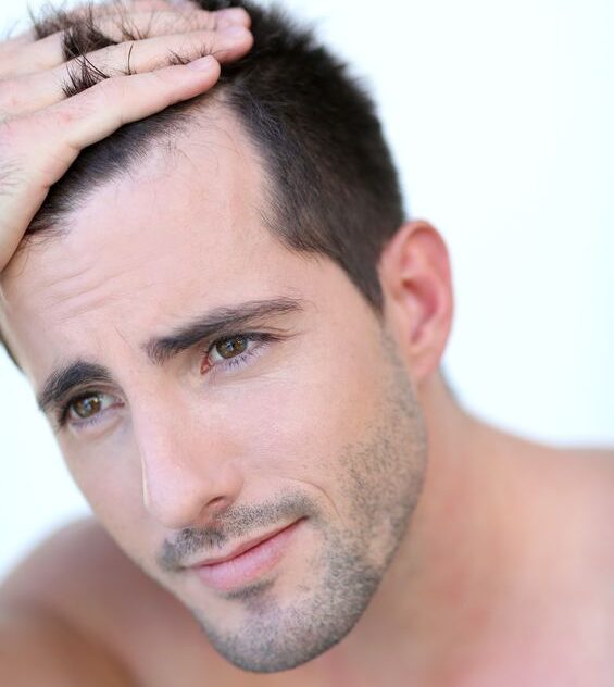 Male pattern baldness treatments at Urban TRT online Male pattern baldness treatments at Urban TRT online