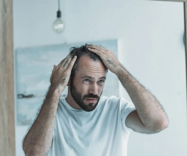 Symptoms of hair loss in Men Treatments online at Urban TRT Symptoms of hair loss in Men Treatments online at Urban TRT