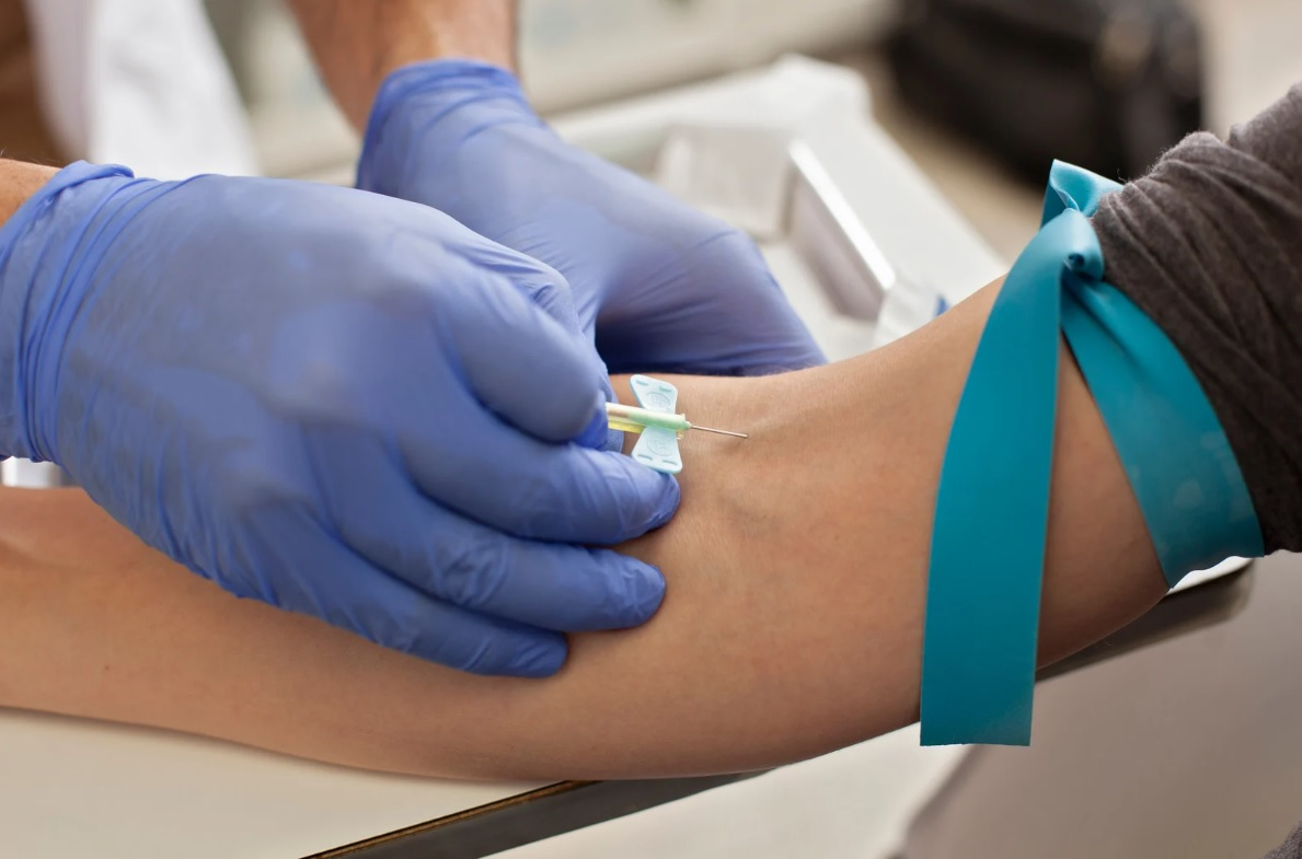 Full Male Hormone Blood Test from Urban TRT TRT Clinic Venous blood test Urban TRT testosterone level blood testing