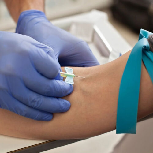 Blood Test 2 Full Male Hormone Blood Test